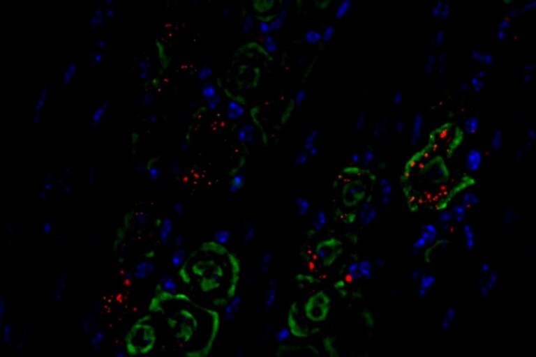 Revolutionary Nasal Spray Could Transform Brain Cancer Treatment