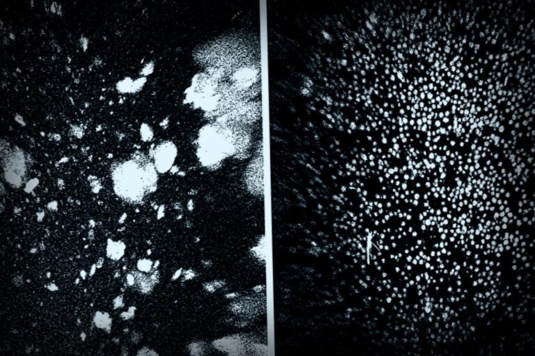 How Space Station Research Is Shaping New Cancer Treatments